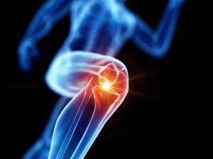 Artrosi o Osteoartrosi: la malattia degli ultraquarantenni colpisce il 40% della popolazione